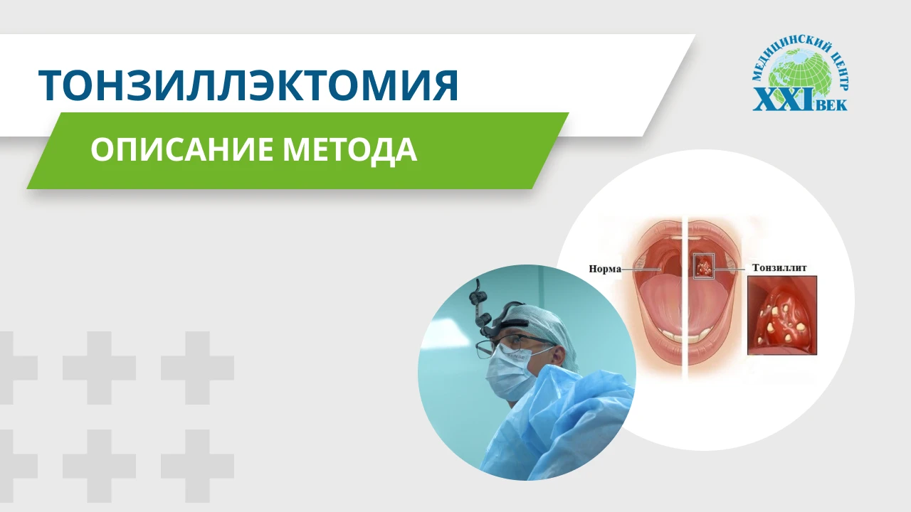 Удаление миндалин: как проводится операция тонзиллэктомия